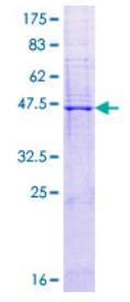 SDS-PAGE (CLDN2-1438H).jpg